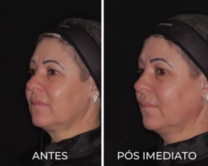 Royal Face Estética - Salto SP