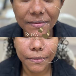 Royal Face Estética - Salto SP